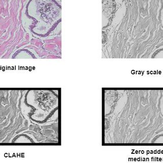Toradh íomhá ar Pre Processing Technuques