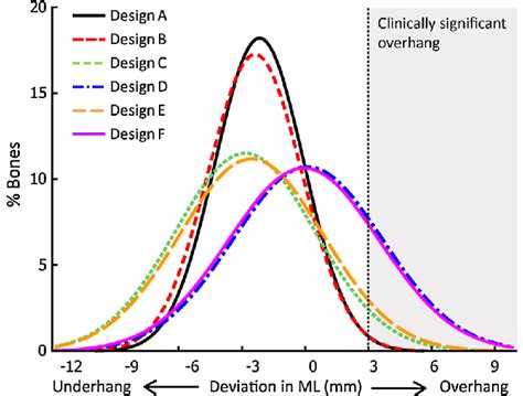 Image result for Overhang Tissue