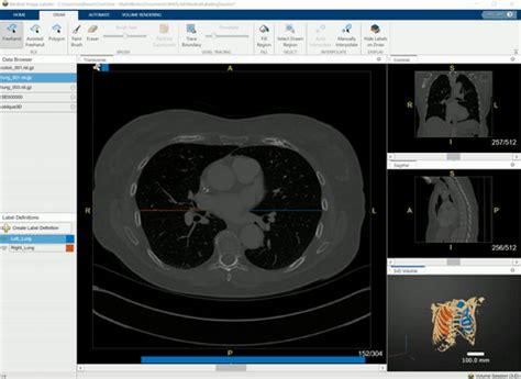 Image result for Medical Imaging Tool Box MATLAB LabVIEW