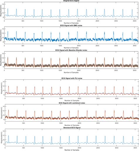 Hand Based ECG Signal に対する画像結果
