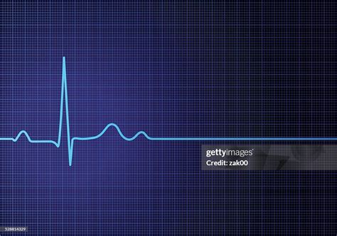 Image result for Heart Rate Monitor Flatline