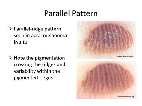 Image result for Parallel in Pattern