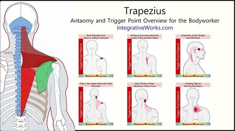 Image result for Trigger Points of Upper Back and Neck
