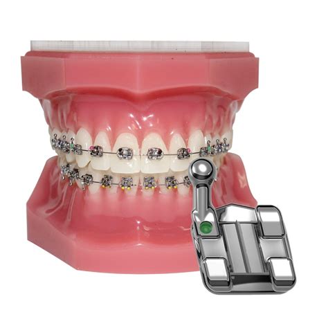Image result for Ortho Spots Brackets