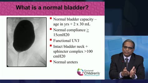 Toradh íomhá ar Pediatric Bladder