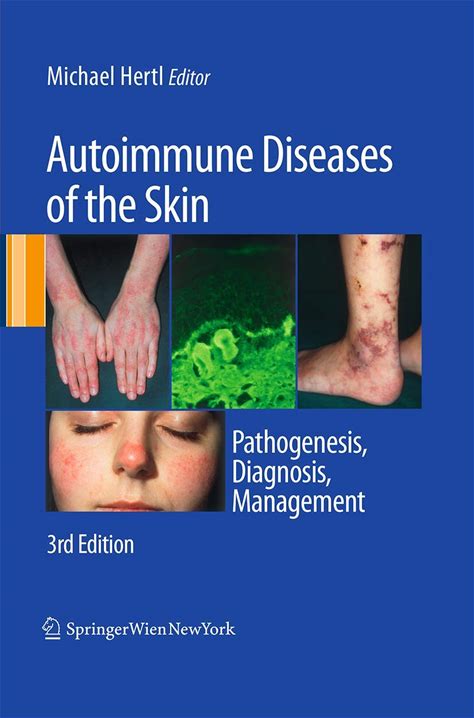 Autoimmune Diseases Of The Skin: Pathogenesis, Diagnosis, Management