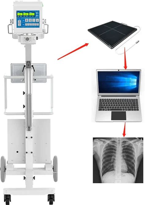 Portable Mobile Digital X-Ray Machine: Hospital 5Kw For Human & Veterinary Use