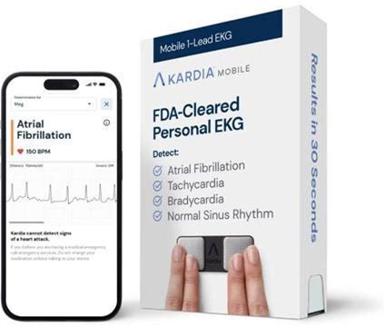 Kardiamobile 1-Lead EKG Monitor, Medical-Grade FDA-Cleared Personal Heart Monitor, Detects Normal, Afib & Arrhythmias, 30 Second Results, Works...