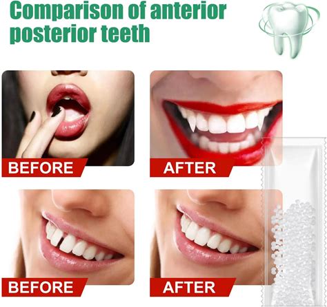 ഉല്‍പന്ന ഇമേജ്