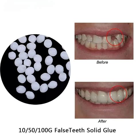 ഉല്‍പന്ന ഇമേജ്