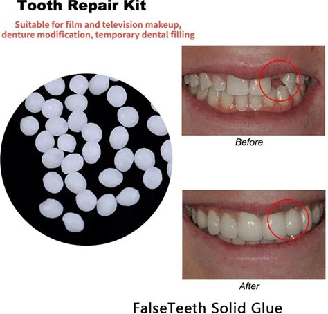 ഉല്‍പന്ന ഇമേജ്