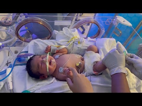 'Miracle' Baby Born After Rare Life-Threatening Pregnancy