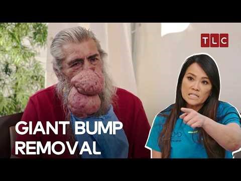 A Life-Changing Pimple Popping Journey | Dr. Pimple Popper S3 EP19 | TLC