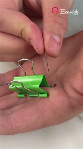 Simple splinter removal method #quick #easy #splinter #trick