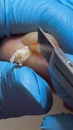 Satisfying Pedicure Video! #pedicure #toenails