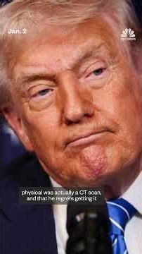 Trump defends health after concerns over bruised hand