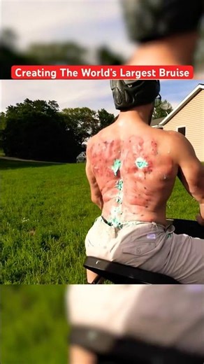 I Tried To Bruise My Entire Back #shorts #funny #entertainment