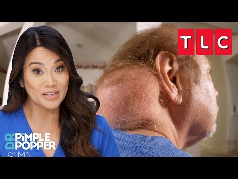 All the Pops from Season 9 Part 2 | Dr. Pimple Popper | TLC