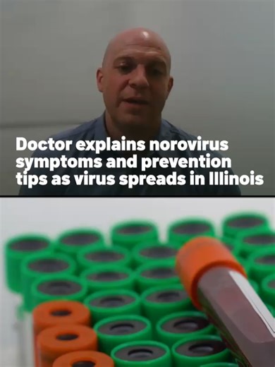 Cases of a highly contagious stomach virus, norovirus, are on the rise in Illinois and the Midwest, and health officials are warning people to take extra precautions as numbers could be even higher than reported heading into the holiday gathering season. What's more, this virus is particularly hard to kill and many may not even realize they're spreading it. Dr. Jonathan Martin, an infectious disease physician with Cook County Health, shares tips to help treat and prevent the spread of this virus
