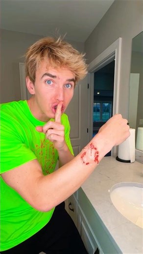 Fake injury Prank on my friends! (FUNNY 🤣🤣)