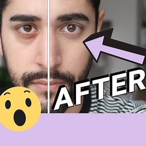 Should I really use an HEMORRHOID cream for THAT?? 😅 | James Welsh