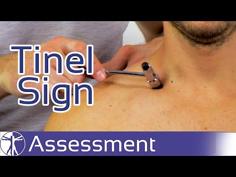 Tinel Sign | Thoracic Outlet Syndrome (TOS)