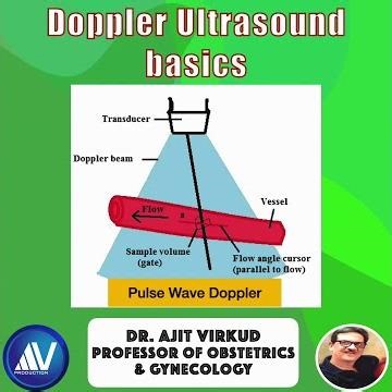 Doppler Ultrasound Basics 03: Doppler Gate
