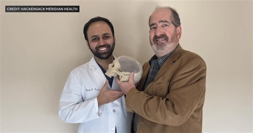 3D printer used to create "perfect puzzle piece" of New Jersey patient's skull