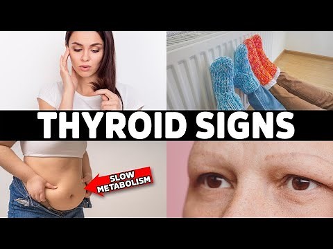 HYPOTHYROIDISM: Don’t Ignore These 7 Early Warning Signs