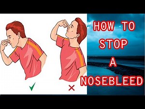 How To Stop A Nosebleed | First Aid For Nose Bleeding At Home