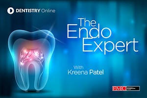 The endo expert – working length and apex locators – Dentistry Online