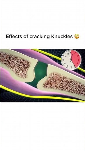 Effects of Cracking Knuckles!