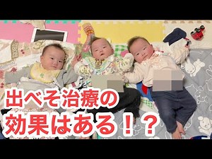 【三つ子の治療】出べそを治せ！０歳児の臍ヘルニア治療体験記