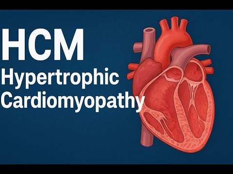 Hypertrophic Cardiomyopathy (HCM & HOCM) Explained | Echo Findings, SAM, LVOT Obstruction & Doppler