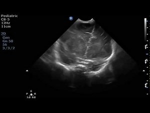 Ultrasound Training: Pediatric Brain