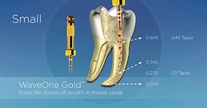 WaveOne® Gold offers you the simplicity of a one-file shaping system combined with higher flexibility* to respect the canal anatomy. Experience the calming confidence of the WaveOne® Gold treatment solution: http://ms.spr.ly/6184eqehr *compared to WaveOne® | Dentsply Sirona