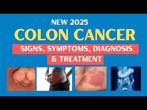 [2025] Colon Cancer (CRC) | Intestinal Cancer (Signs, Symptoms, Diagnosis & Treatment)