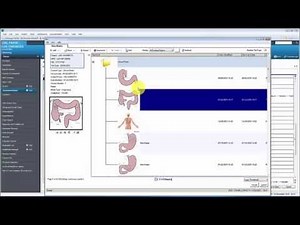 Colonoscopy report example using Cerner (with Mouse-over clicks)