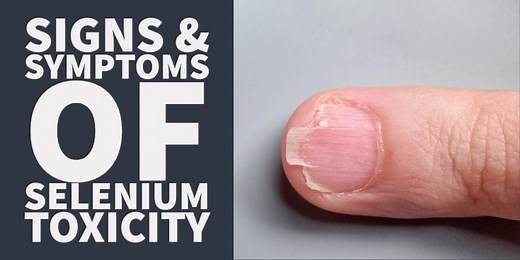Signs and Symptoms of Selenium Toxicity – Are you Taking Too Much?