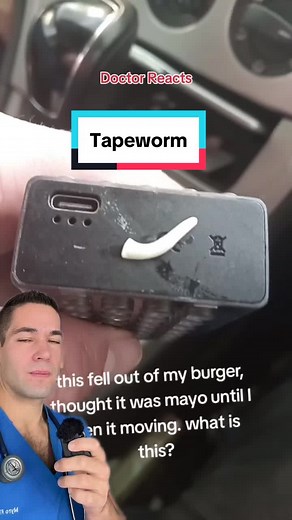 Tapeworm Symptoms and Prevention | Doctor Reacts