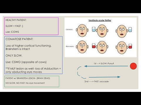 Caloric Testing (Vestibulo-occular relfex)