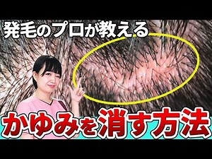 【正しいケア】頭皮の痒み、フケの原因と対策教えます。