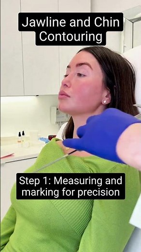 Jawline and Chin Contouring