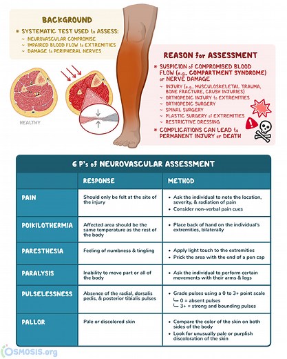 Neurovascular Assessment: What Is It, Why It’s Performed, and More | Osmosis