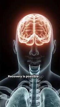 Functional Neurological Disorder (FND) Explained in Under 2 Minutes | Symptoms & Treatment