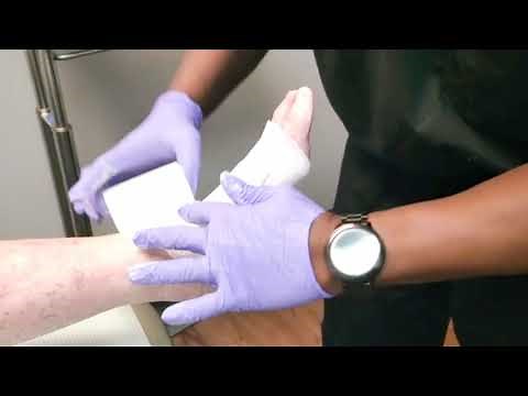 Unna Boot Application by Podiatrist, Dr. Ejiro Isiorho