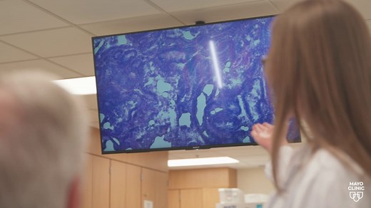 Understanding endometrial cancer: Symptoms, risk factors and treatments - Mayo Clinic