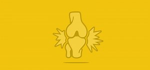 Gout and pseudogout (crystal arthropathies) - Oxford Medical Education