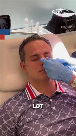 Male Botox® Injection Demo (Part 3) | Live at the IAPAM Aesthetic Medicine Symposium 💉 #botox