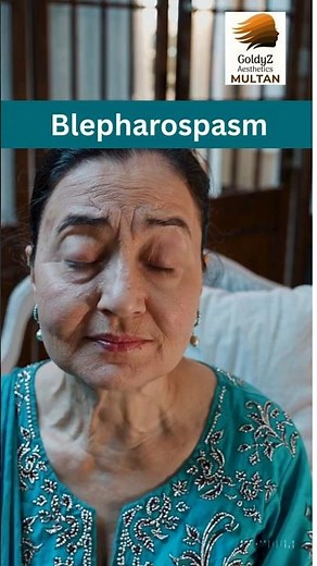 Botox | Blepharospasm Treatment | #multan #goldyz #botox